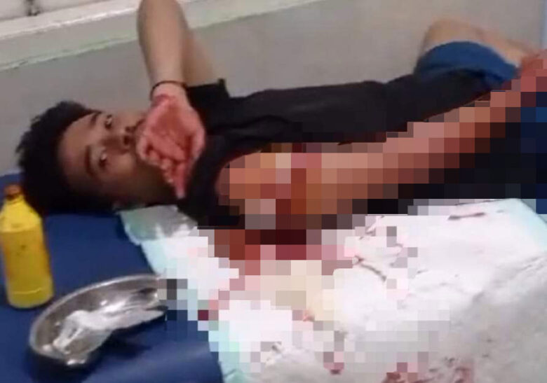 korban pembacokan orang tak dikenal gresik