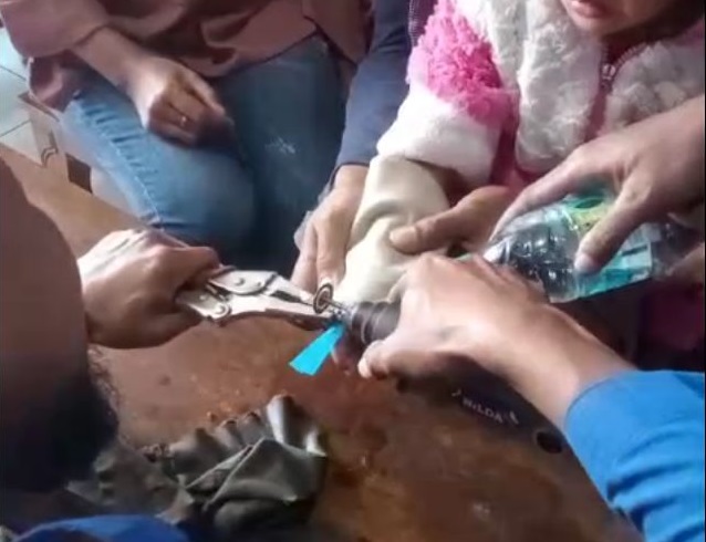 Proses pelepasan cincin di jari anak kecil oleh Damkar Mojokerto.(Blok-a.com/Syahrul Wijaya)