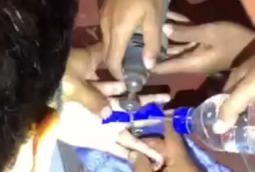 Proses pelepasan jari siswi SMP yang terjepit engsel jendela.(tangkapan video)
